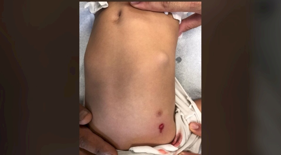 حدث في الناصرة.. بدأ الطفل بالبكاء و الصراخ ليكتشف الاهل انه مصاب برصاصتين