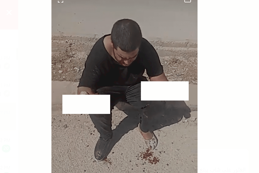 صور| في الأردن: قطع يدي فتى واقتلاع عينيه للثأر من والده!