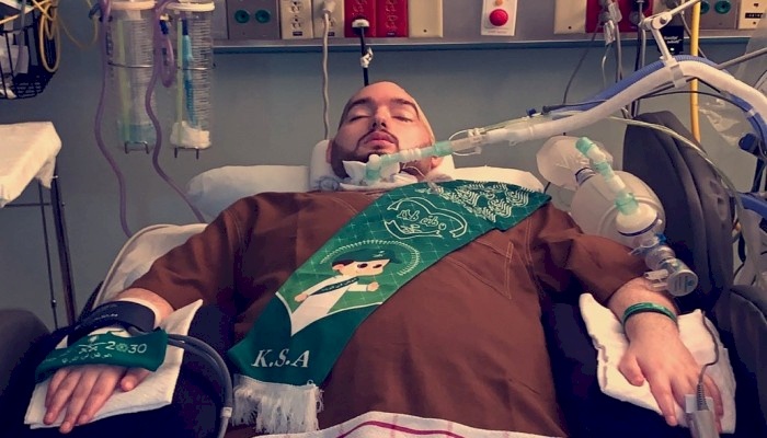 فيديو : رد فعل مفاجئ من "الأمير النائم" في غيبوبة منذ 15 عاما...