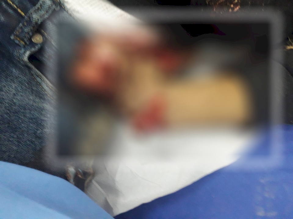 الشرطة تكشف تفاصيل جديدة عن جثة الشاب مبتورة اليدين بنابلس