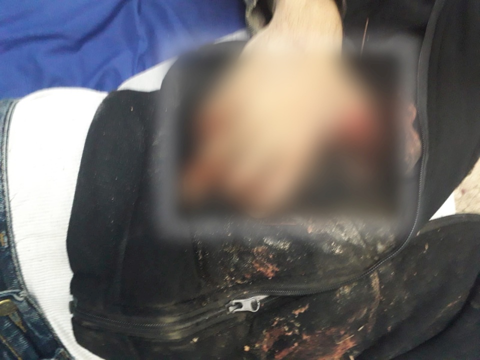 بالصور- العثور على جثة شاب مبتور اليدين قرب نابلس