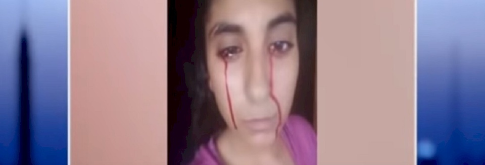 فيديو: قصة فتاة مصرية يخرج الدم من عينيها وفمها وأنفها عجز الطب عن علاجها