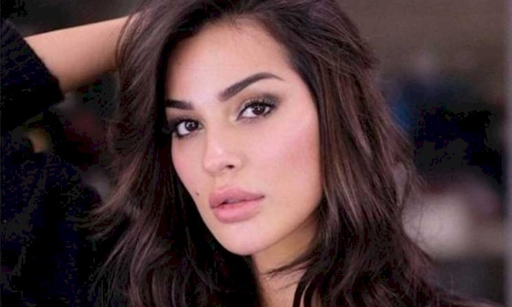 شاهد- نادين نجيم تكشف صور إصابتها البالغة بعد إنفجار بيروت