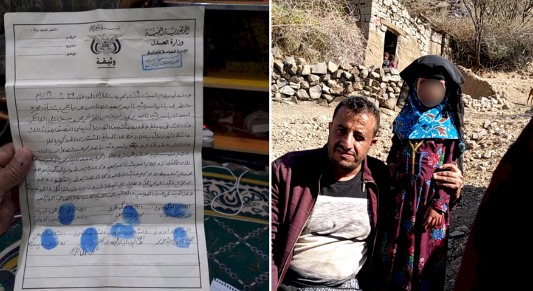 تفاصيل صادمة - قصة الطفلة اليمنية التي باعها والدها مقابل 300 دولار!