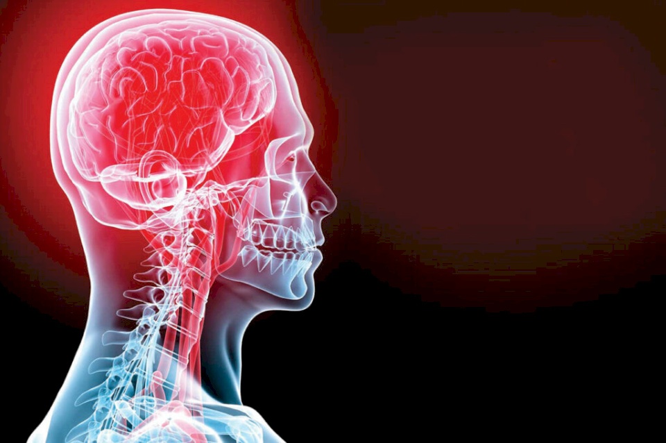 هكذا يمكن تقليل احتمالات الإصابة بسكتة دماغية