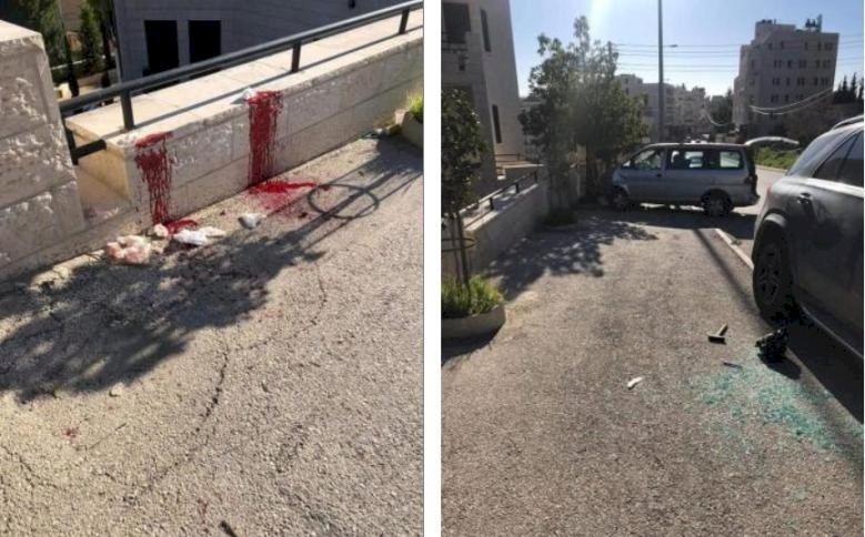 في بيت لحم: طعنوه في جميع أنحاء جسده وحاولوا ذبحه- الشرطة تعتقل مشتبهاً به