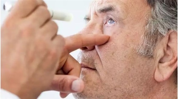 مرض كورنا الحاد يمكن أن يسبب تشوهات خطيرة في العين