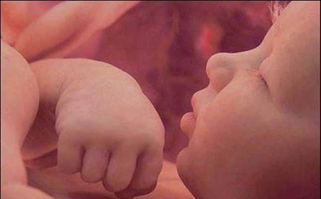 مفاجأة صادمة بسبب زواج الأقارب في مصر.. كيف ظهر المولود لحظة ولادته (فيديو)