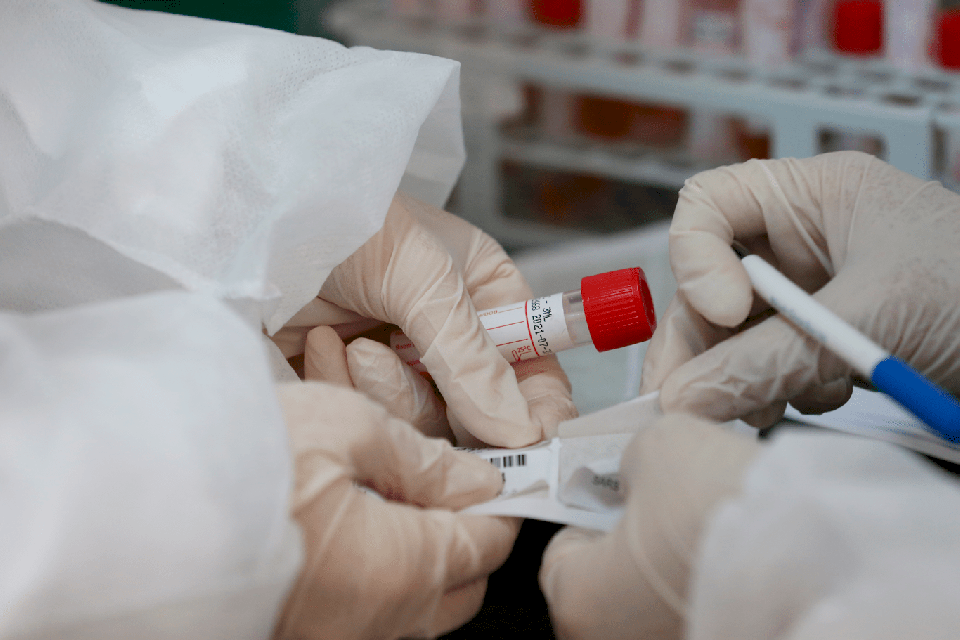 صحة غزة: حالة وفاة و246 إصابة جديدة بفيروس كورونا