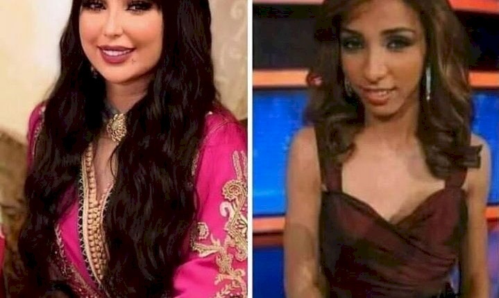 شاهد| هكذا اصبح شكلها بعد عمليات التجميل.. دنيا بطمة تفاجئ الجمهور بوجه جديد!