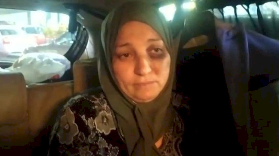11 غرزة في الرأس وكدمات.. المصرية ضحية الجزار تروي تفاصيل الواقعة