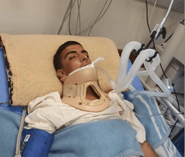 استشهاد فتى من رام الله متأثرا بإصابته برصاص الاحتلال 