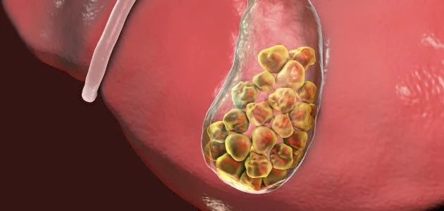 Un médicament ralentit la dégradation des reins chez les patients non diabétiques