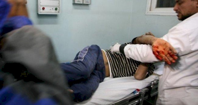 بتر أصابع شاب وحروق في جسده بسبب الألعاب النارية بالخليل
