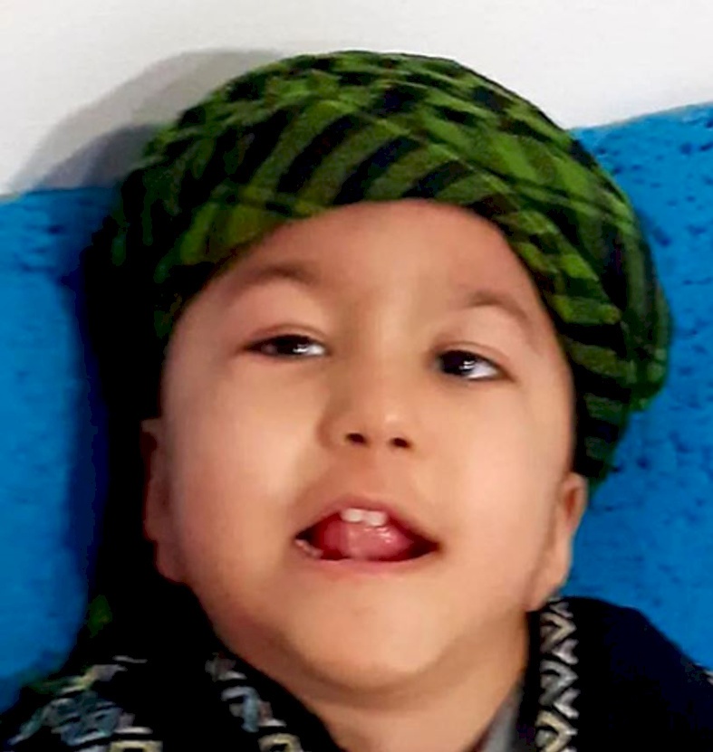 مرض وراثي يفتك بعائلة من رهط: وفاة الابن الخامس!