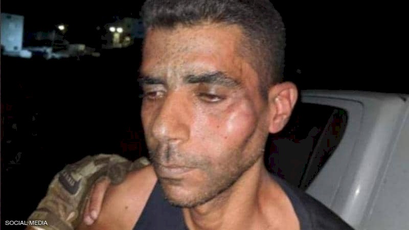 شقيق زكريا الزبيدي يوجه رسالة مؤثره له: "شو ضل بجسمك يخوي"