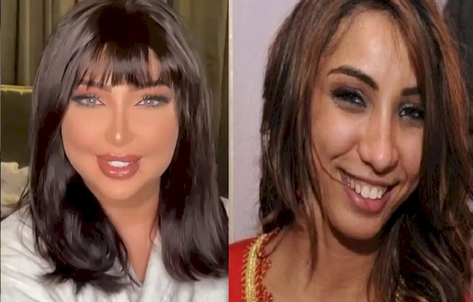 دنيا بطمة تعترف أخيراً وتكشف سر تغير شكلها .. ليس عمليات تجميل! 