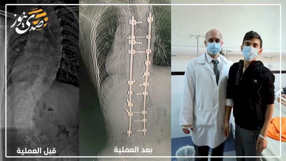 في مجمع فلسطين الطبي.. عملية خطيرة جدا تنقذ شابا يعاني من مرض محرج