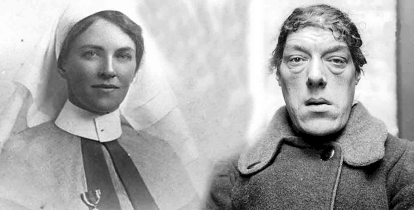 تغيرت حياتها فجأة.. سر تحول "ماري" من امرأة فاتنة الجمال لأقبح سيدة بالعالم!