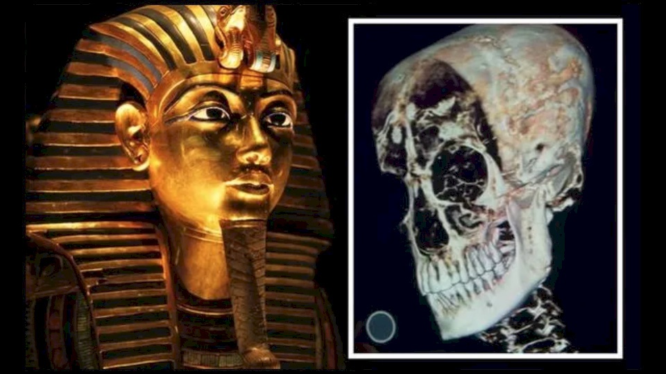فحص مقطعي لجمجمة الملك توت عنخ آمون يكشف تفاصيلاً "غير عادية"
