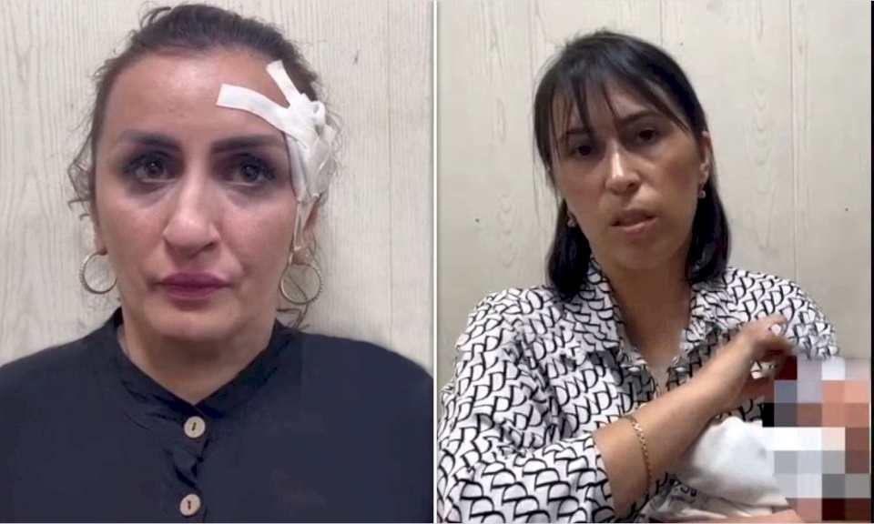 روسيا.. باعت ابنتها الرضيعة لاجراء عملية تجميل بأنفها!
