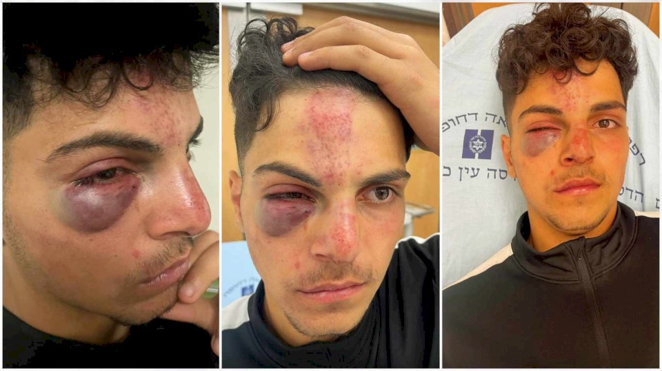 مستوطنون يعتدون بالضرب على فتى بالبلدة القديمة في القدس (صور)