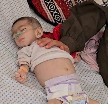 استشهاد رضيعة بفعل الجوع في غزة