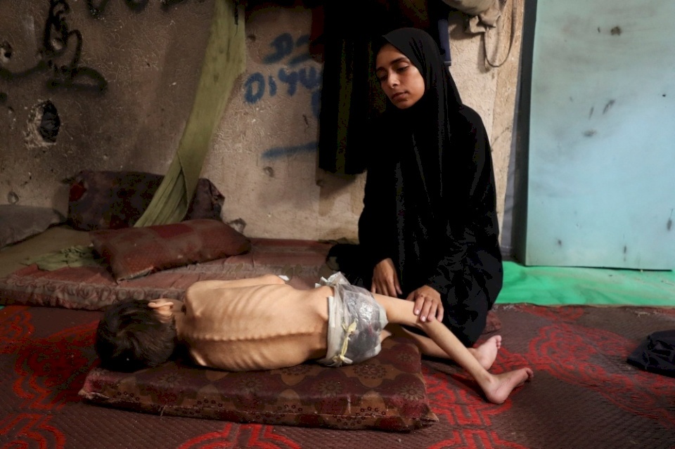 لا مكان آمن.. وفيات جديدة بفعل المجاعة في قطاع غزة والمئات مهددون