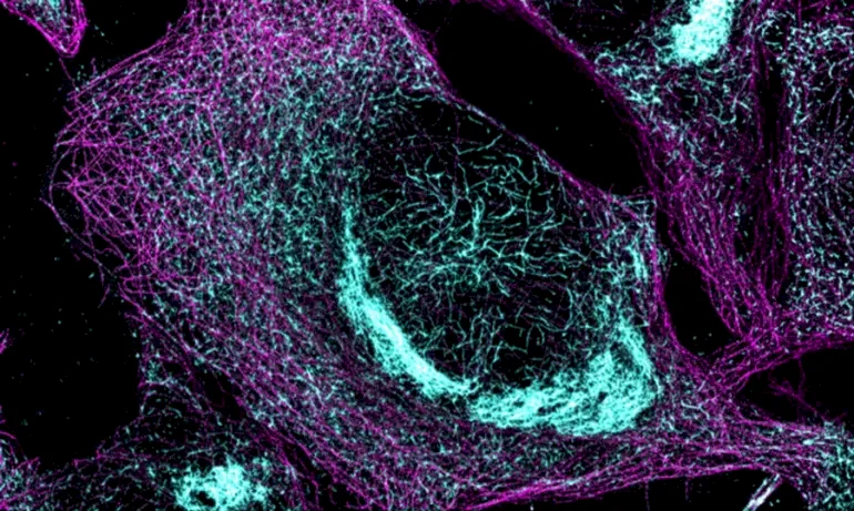 الكيمياء تكشف سر "الفراء" الذي يحيط ببروتينات الدماغ