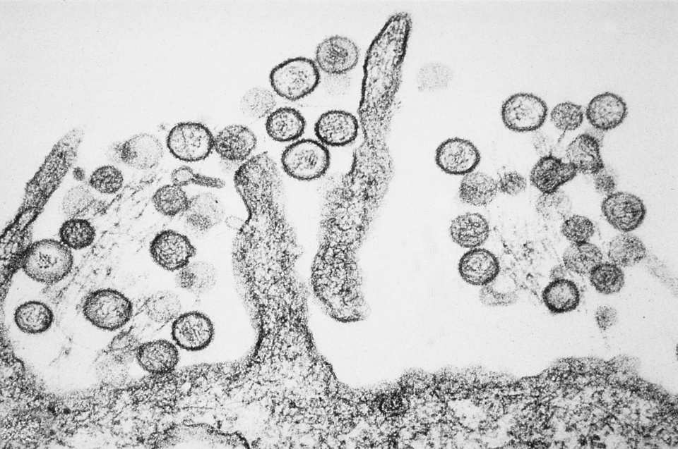 Que savons-nous sur le virus Hanta mortel ?