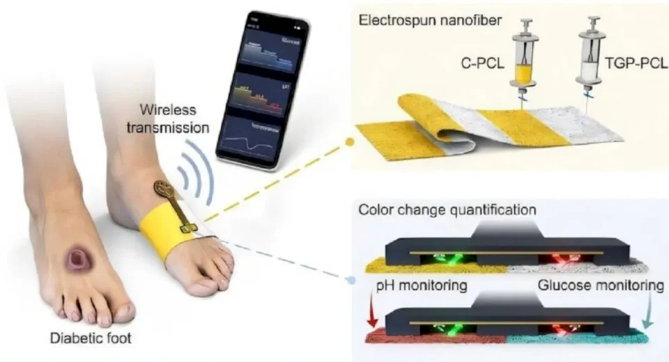 Un bandage intelligent surveille les blessures des patients diabétiques et prévient le risque d'amputation