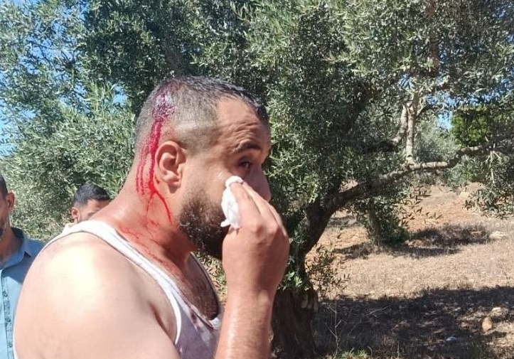 פציעת שלושה אזרחים בהתקפה של מתנחלים מזרחית לסלפית